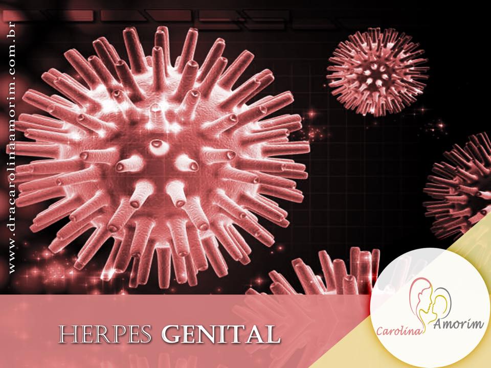 herpes genital feminina